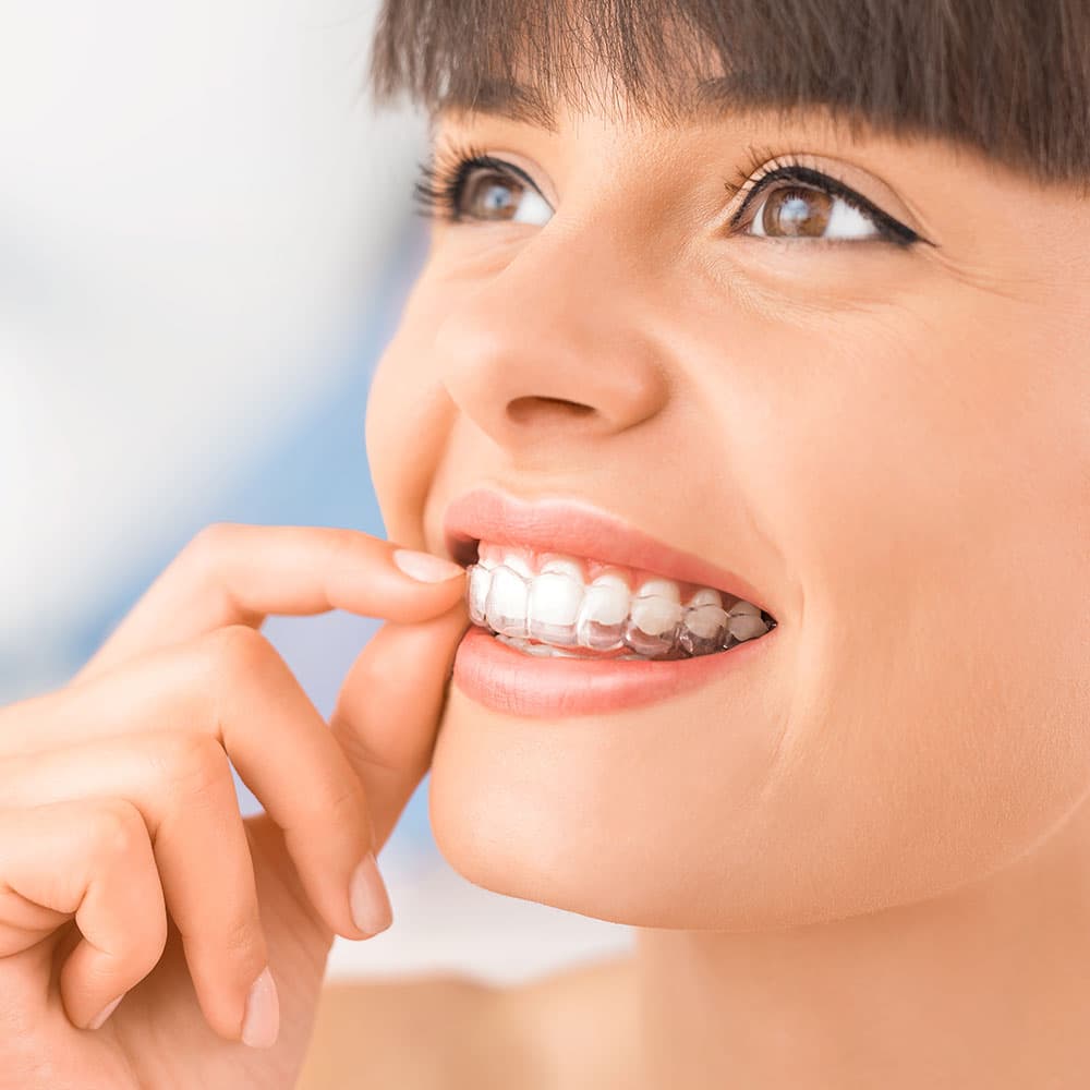 Invisalign Services At Mork Dental